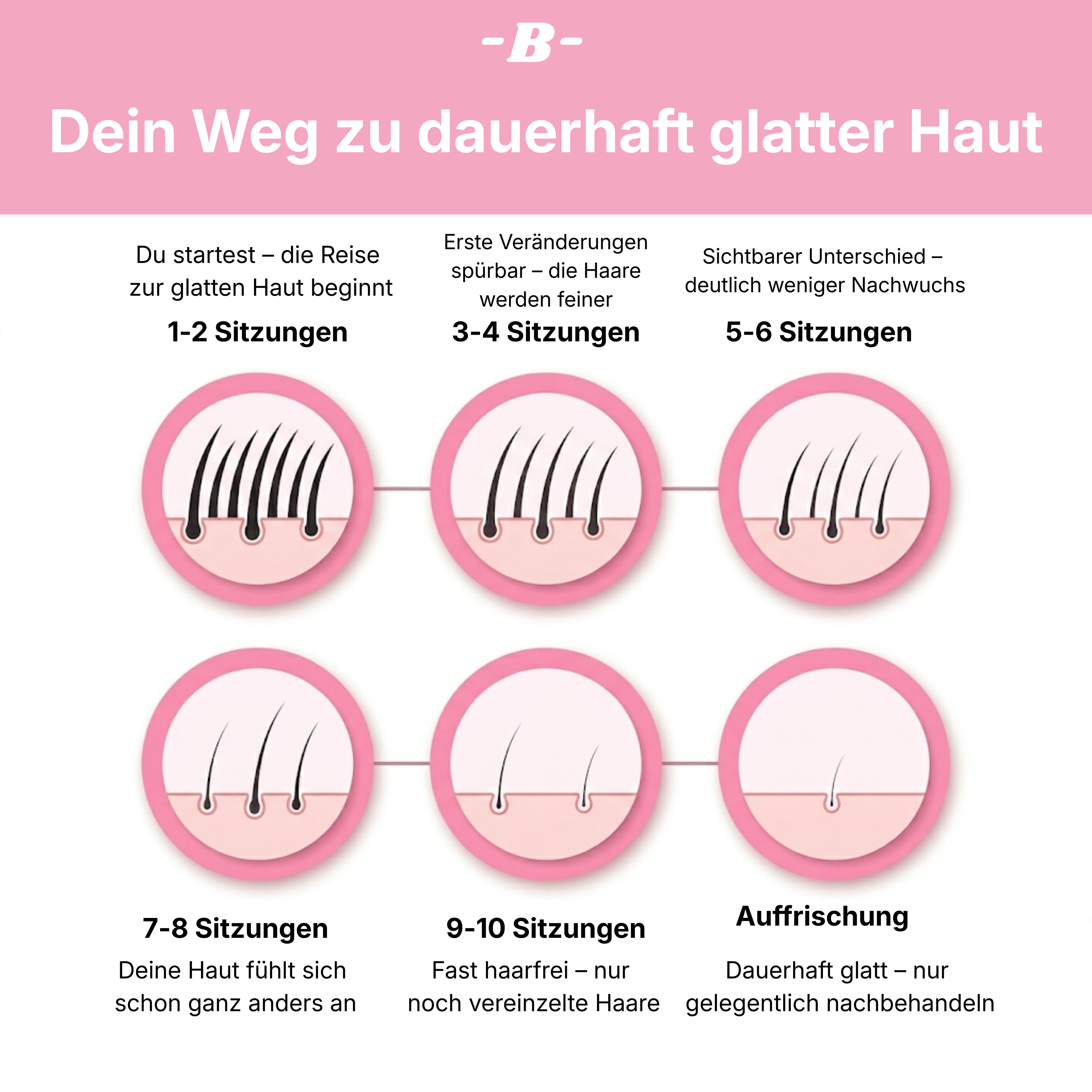 Baleva SoftPulse I Der IPL Haarentferner